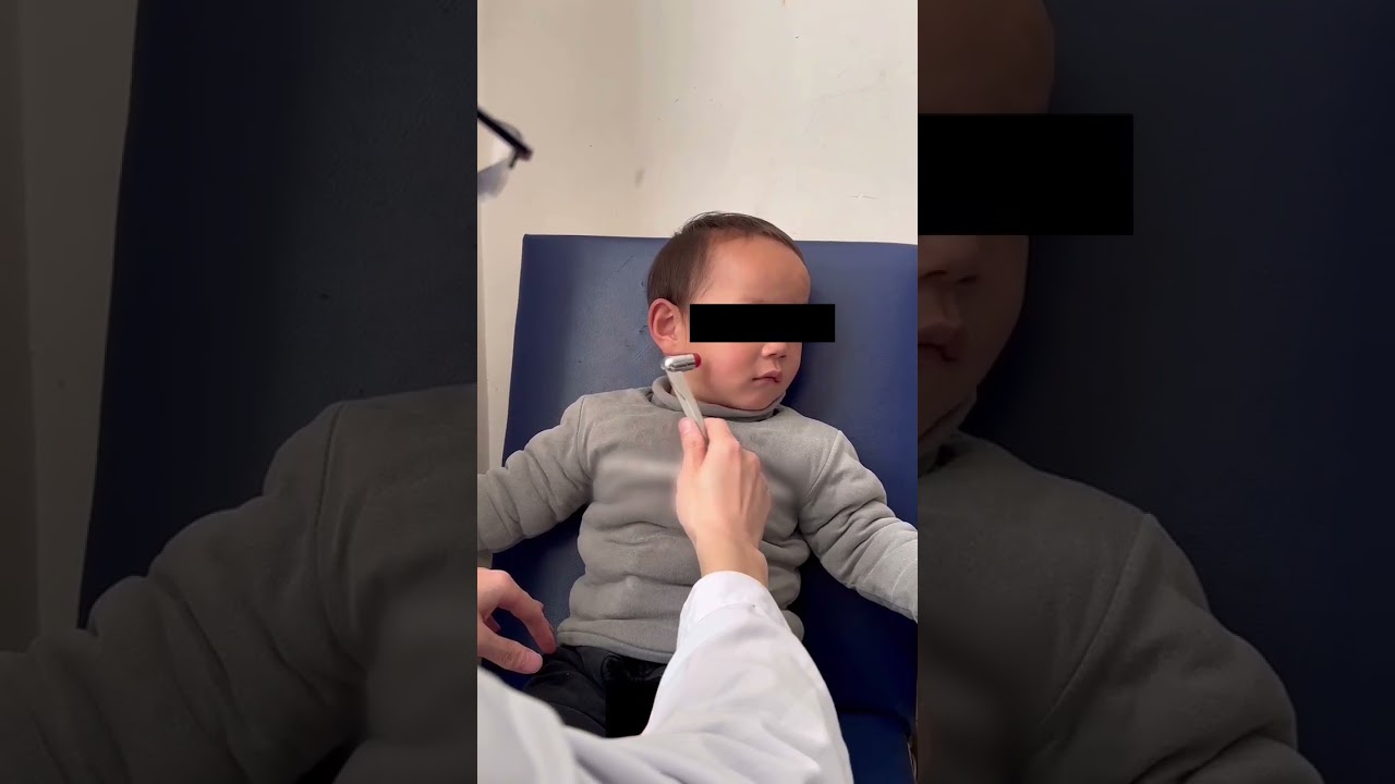 Images in Clinical Medicine: Chvostek&rsquo;s Sign in Familial Hypoparathyroidism