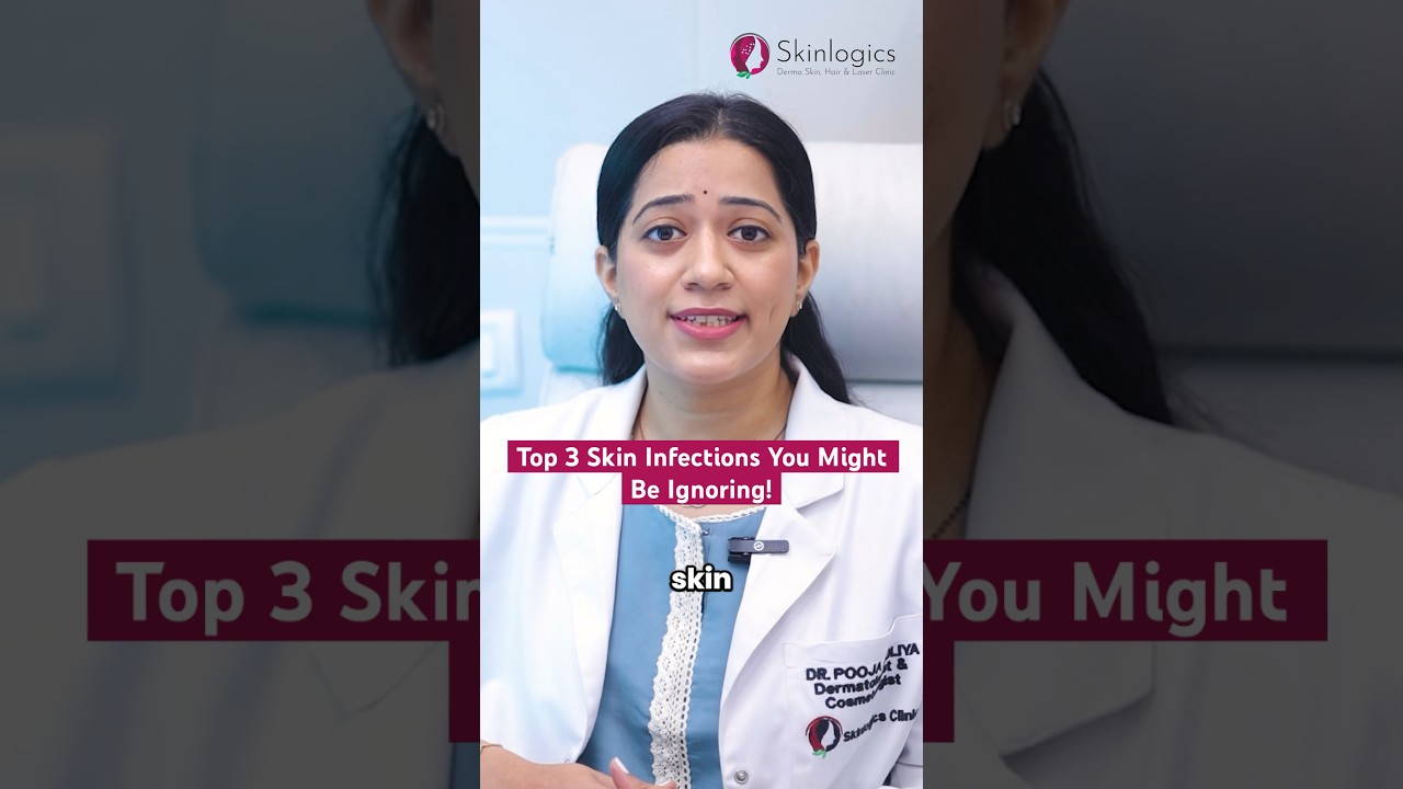 Types of Skin Infection | Skin Infection Treatment | Best Skin Doctor in Noida | Skinlogics Clinic