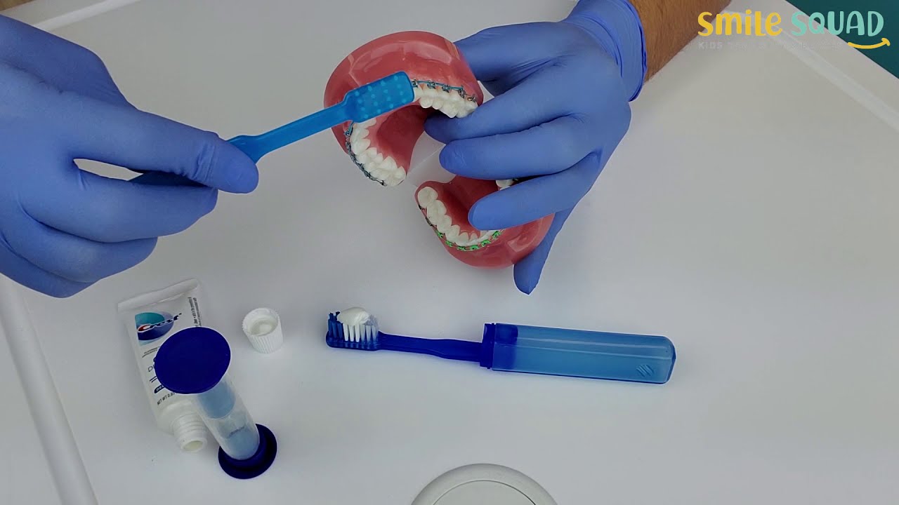 How to Brush your Teeth with Braces 2 Minute Brush Along. Explained by Dr. Martinez
