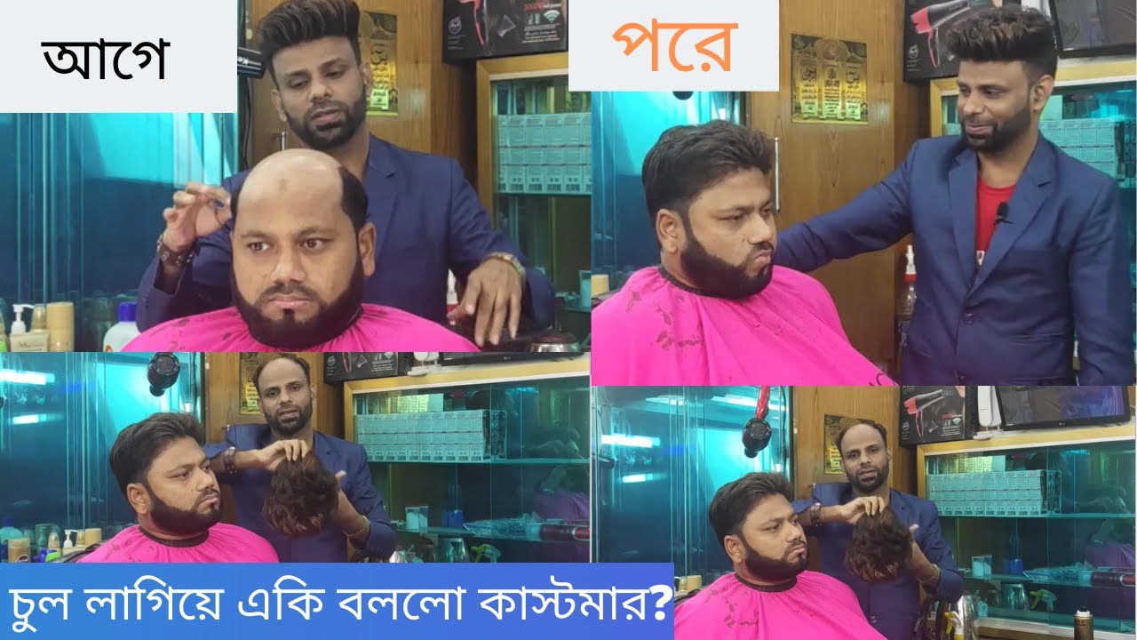 non surgical hair replacement in Bangladesh Hair Expert Shamim Call for details: 0195 200 4000