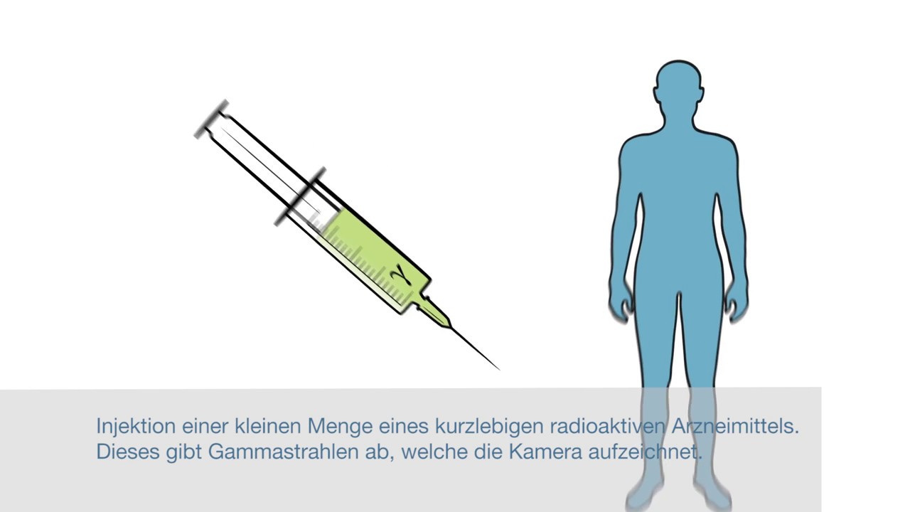 Nuklearmedizinische Untersuchung - Institut für Radiologie und Nuklearmedizin – Stadtspital Triemli