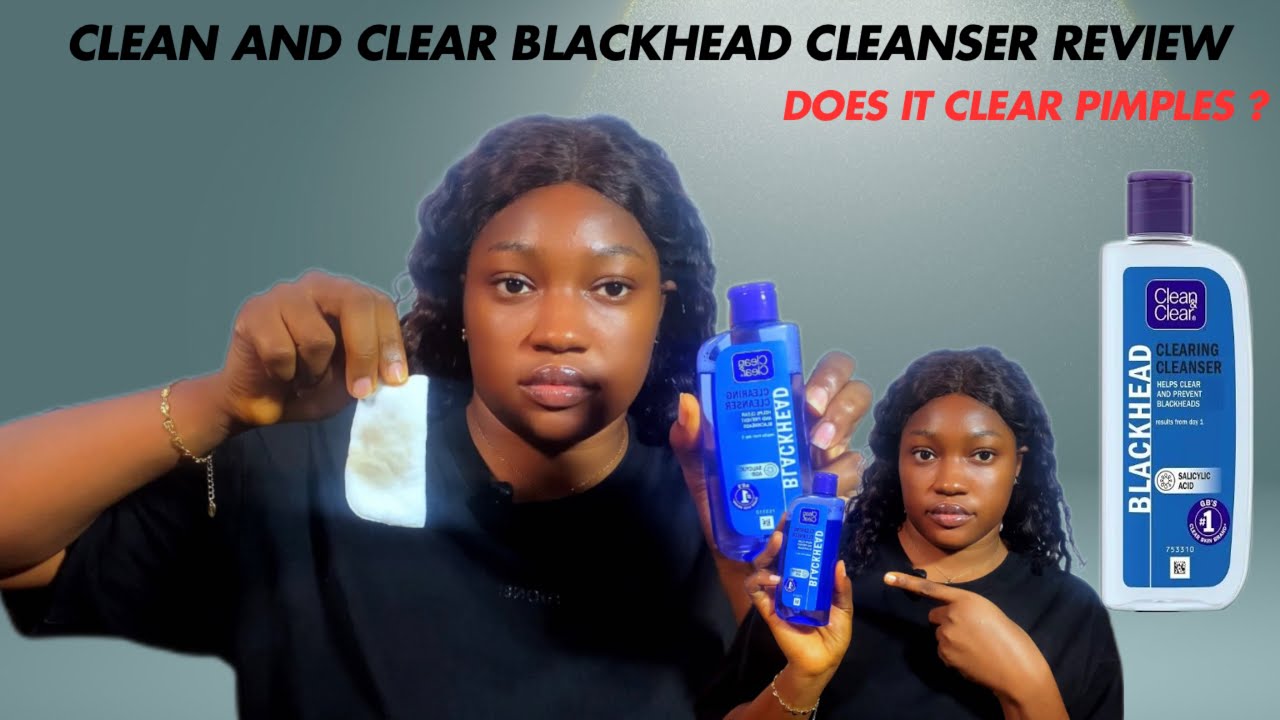The only product you need to clear your pimples | Clean & clear black head clearing cleanser review