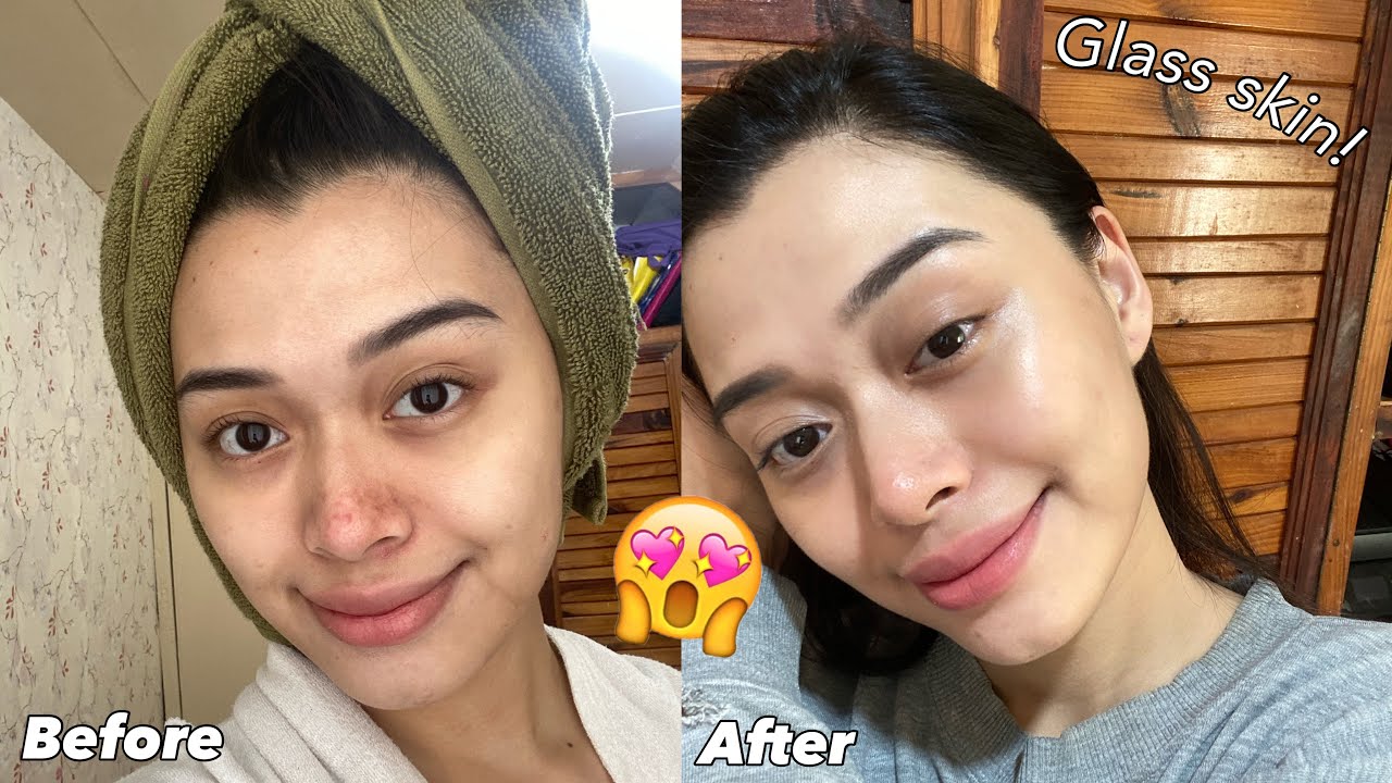 HOW I CLEARED MY SKIN? Glass Skin ang Peg?! Beauty Vault Rejuvenating Set Review | Maria Selina