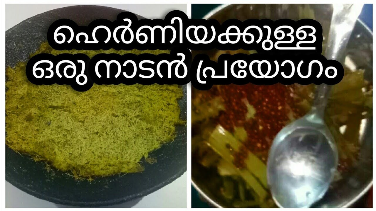 ഹെർണിയ മാറാനുള്ള ഒറ്റമൂലി||natural remedy