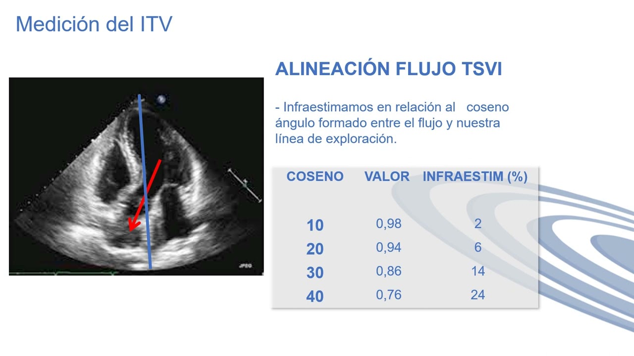 A2 Medicion VTI