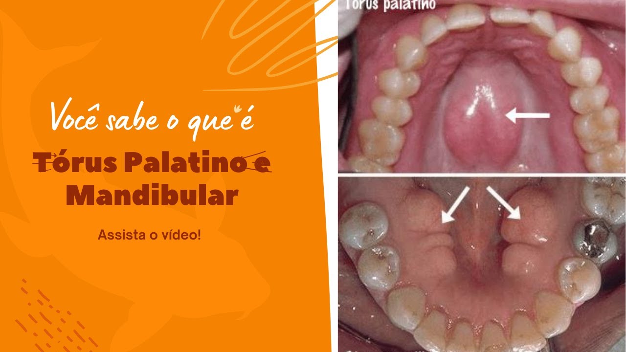 COMO O 