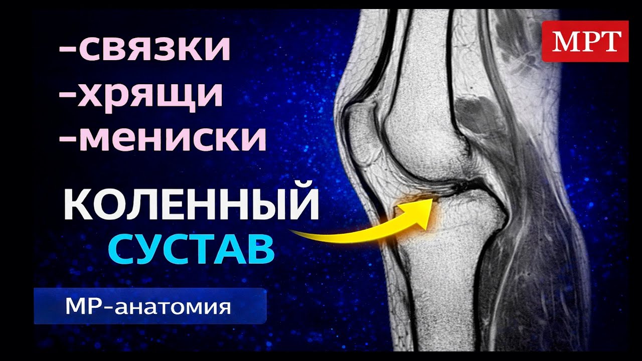 МРТ коленного сустава: базовая анатомия по шагам