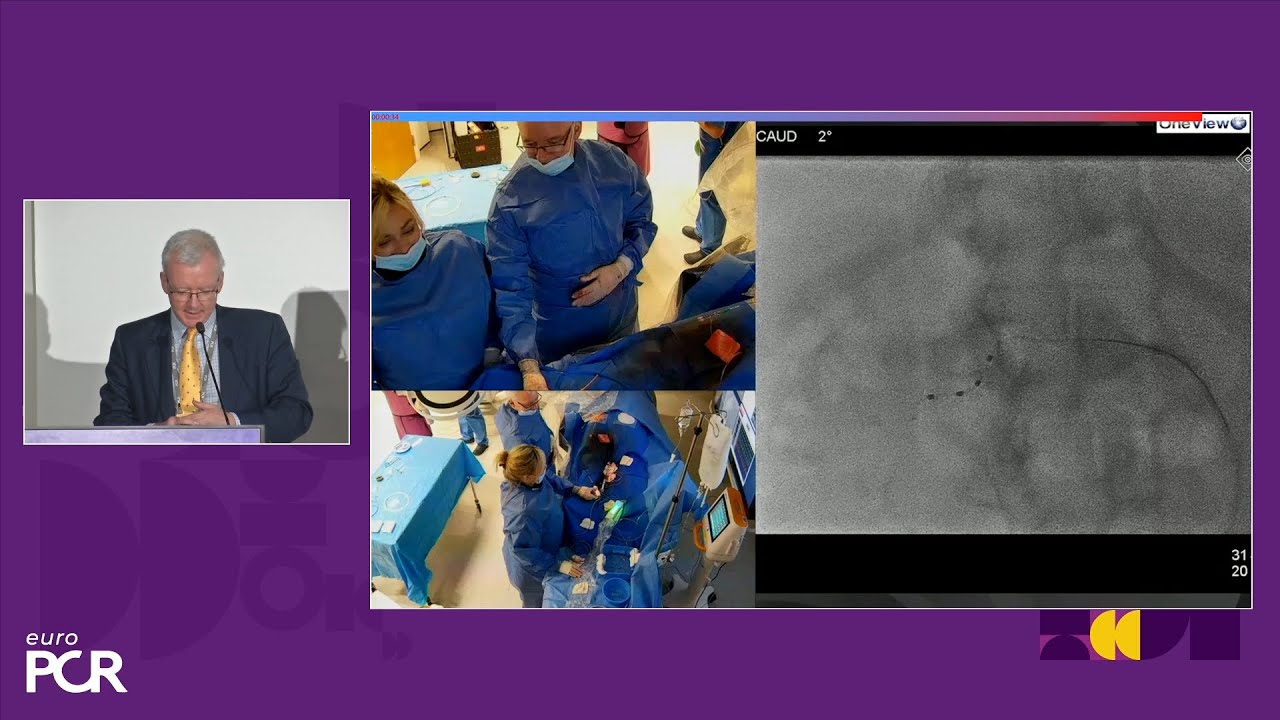 The turning point in hypertension care: Symplicity Spyral renal denervation in practice - EuroPCR