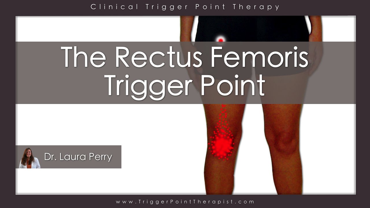 The Rectus Femoris Trigger Point