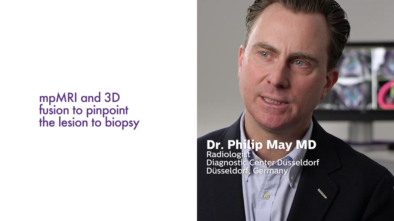 UroNav - Targeting higher precision and better outcome in prostate diagnostics