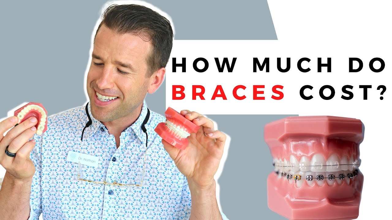 How Much Do Braces Cost? | Braces | Dr. Nate