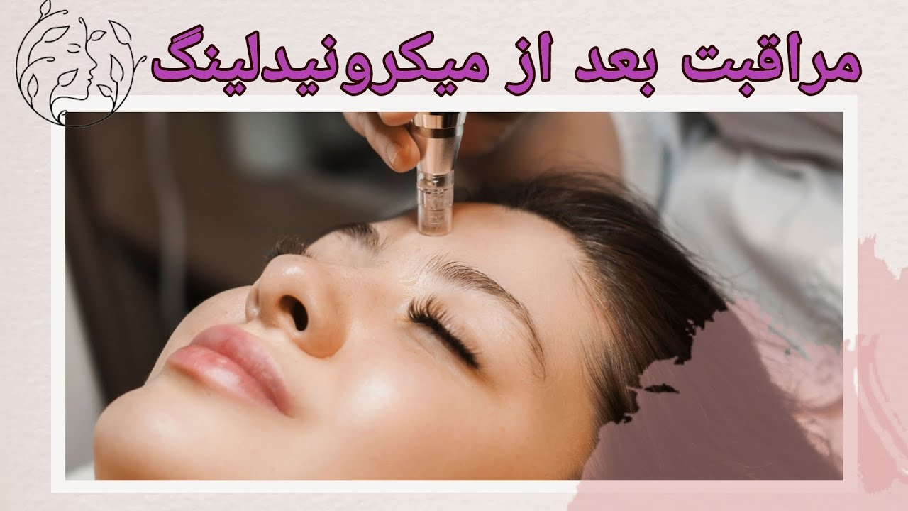 مراقبت بعد از میکرونیدلینگ | بعد از میکرونیدلینگ چکار کنم | بهترین آموزش مراقبت بعد از مزونیدلینگ