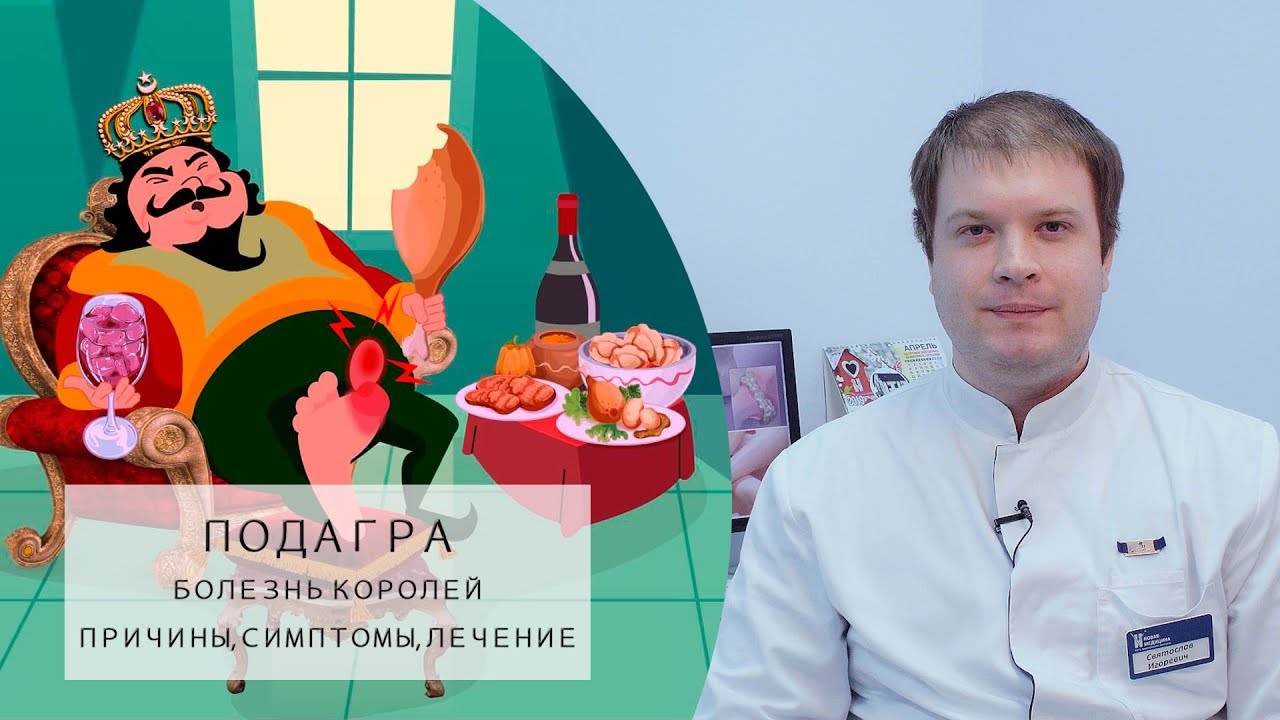 ПОДАГРА | Болезнь королей? | Причины, Симптомы, Лечение!