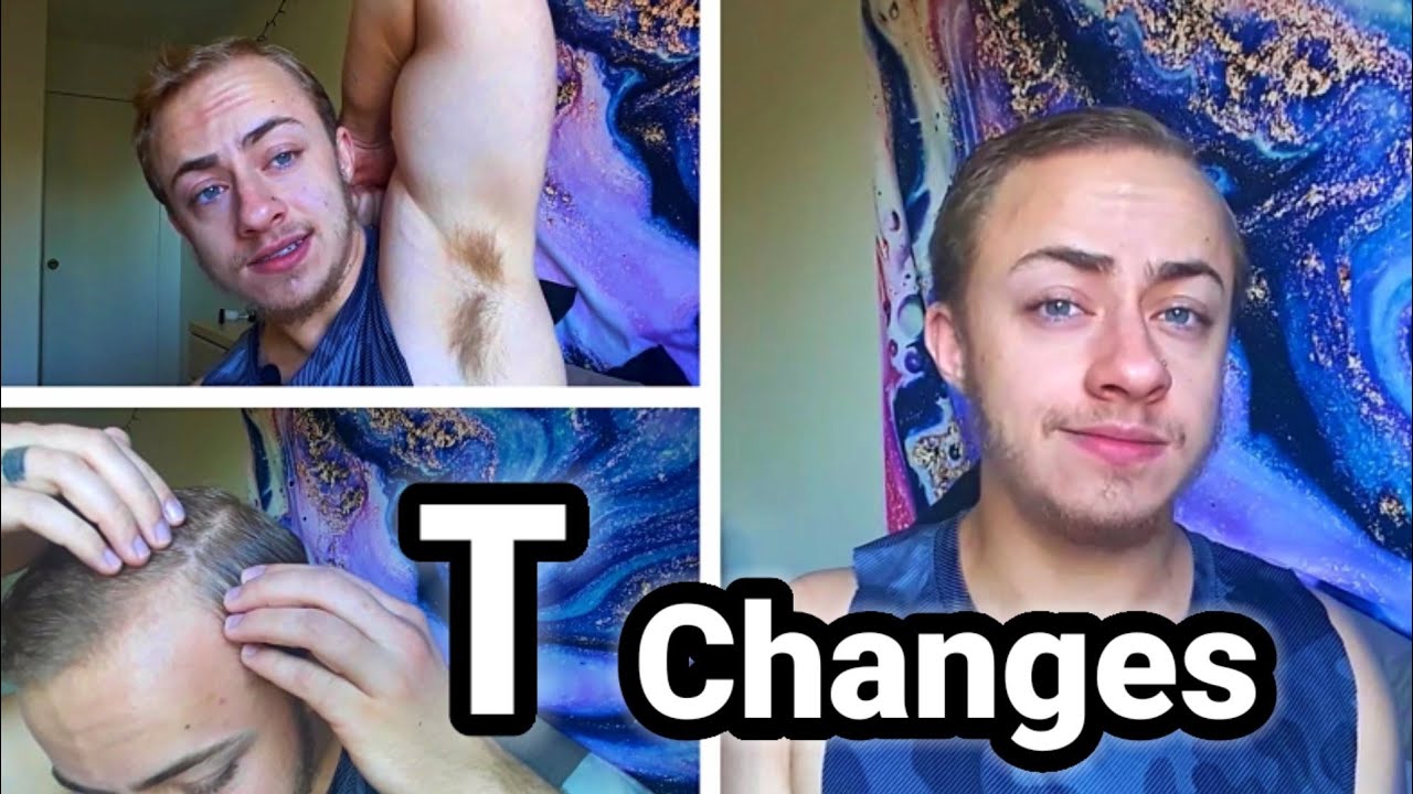 WORST Changes on Testosterone - Ftm Transgender