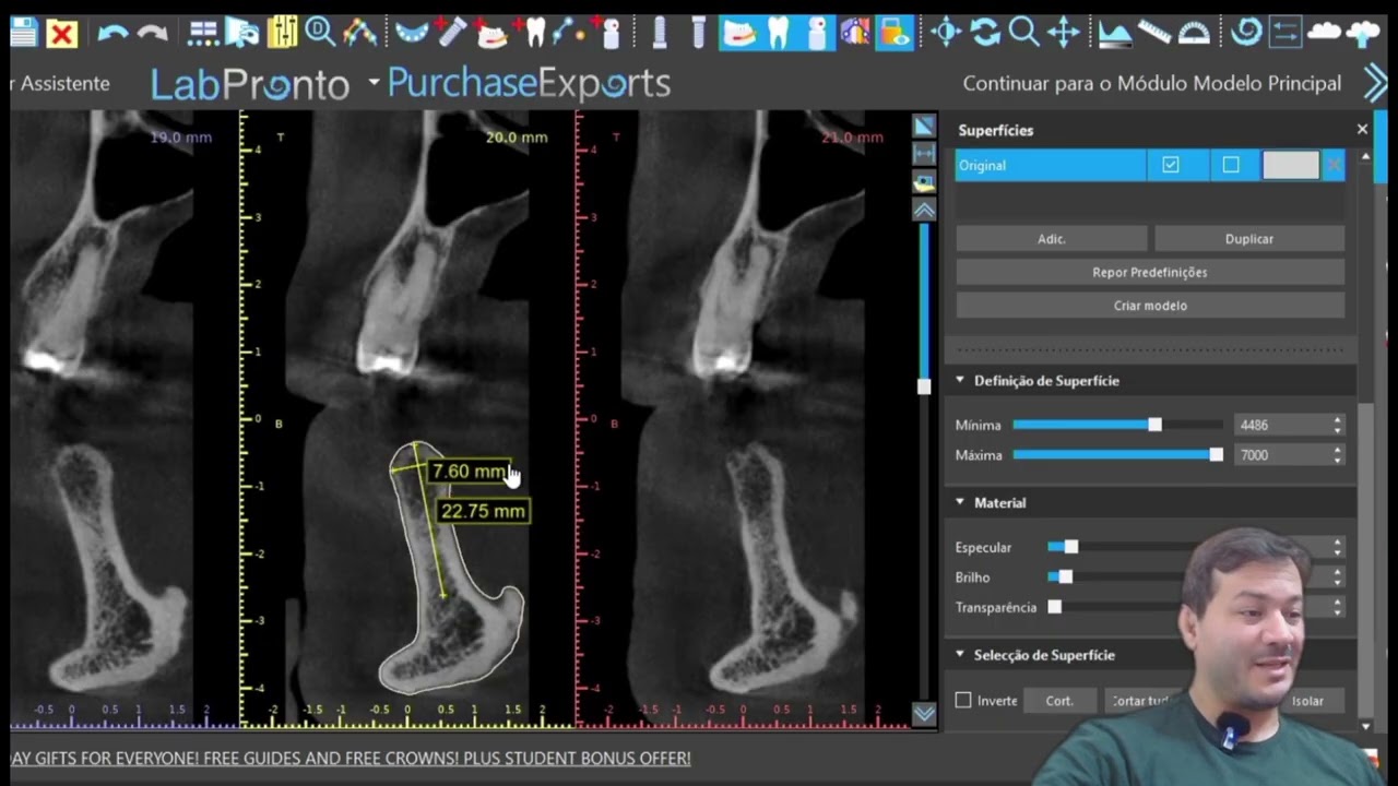 PLANEJANDO IMPLANTES 