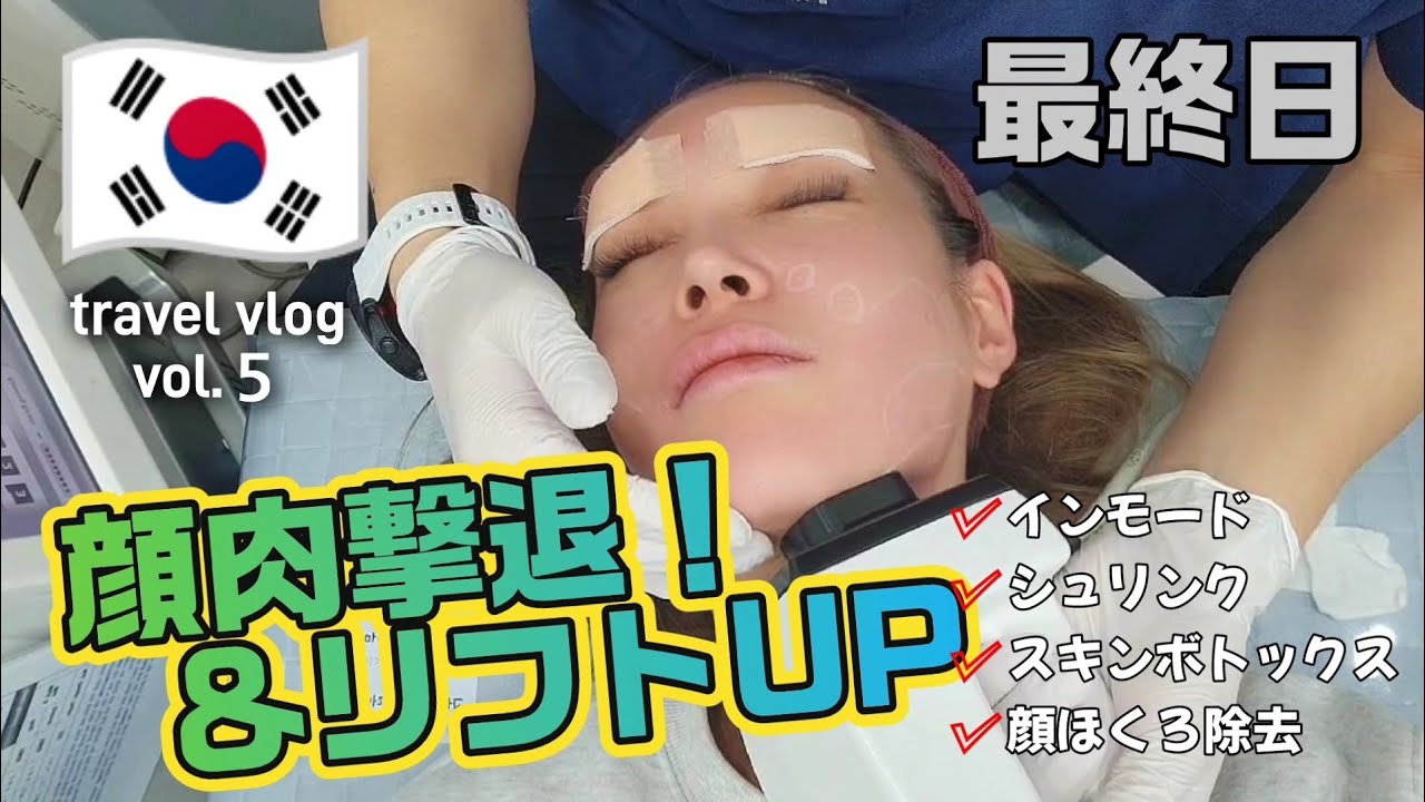 【🇰🇷韓国旅行vol.5】この施術の1ヶ月後、顔がちっちゃくなりました♪