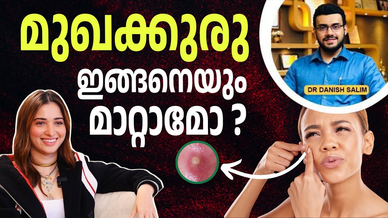 2291 : മുഖക്കുരു മാറ്റാൻ Tips | Tamannaah's Pimple Secret?