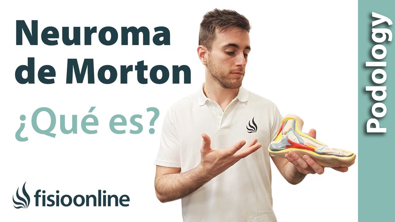 NEUROMA de MORTON, qué es, causas y TRATAMIENTO
