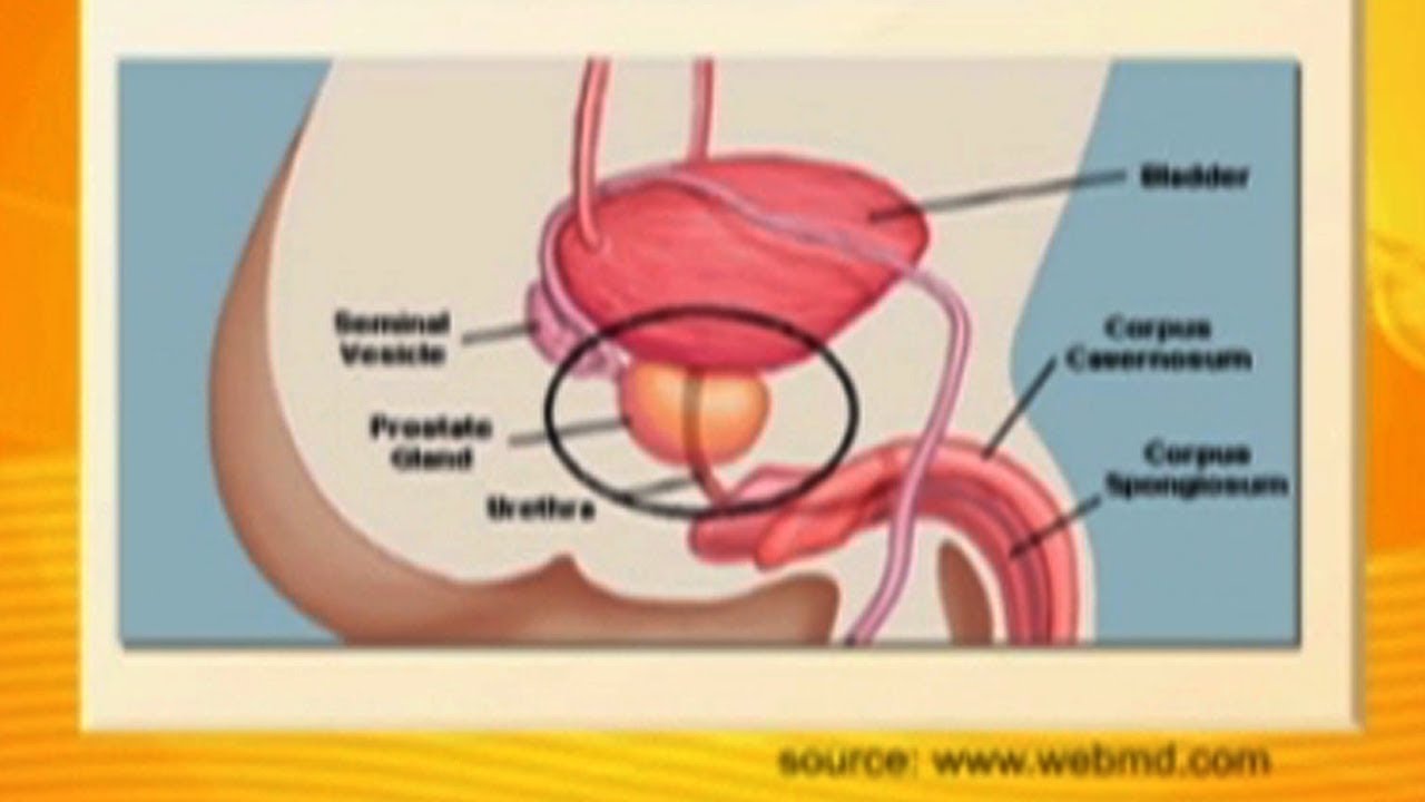 All about Prostate gland / benign prostatic hyperplasia (BPH) | Usapang Pangkalusugan