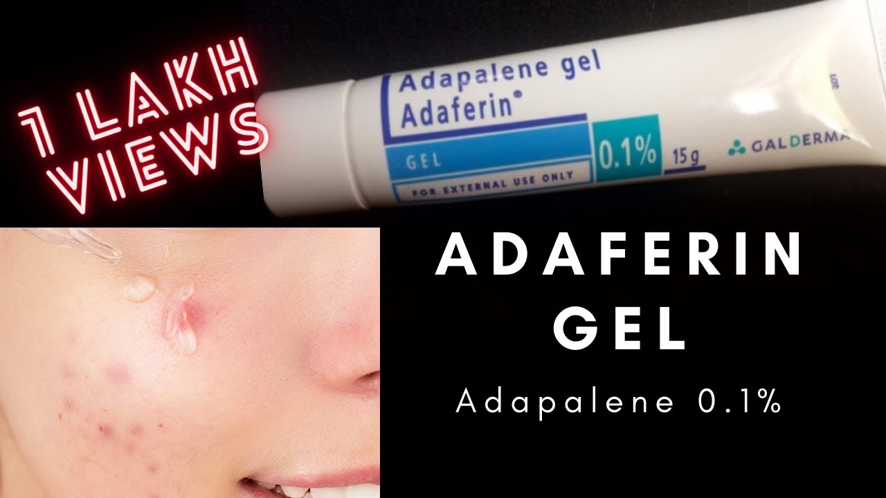 Adaferin Gel Review l FADE PITTED ACNE SCARS l Shinebright #acne#oilyskin