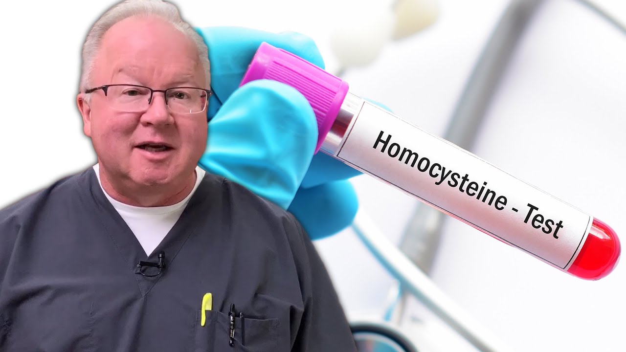 The Top Five Side Effects of a High Homocysteine Level