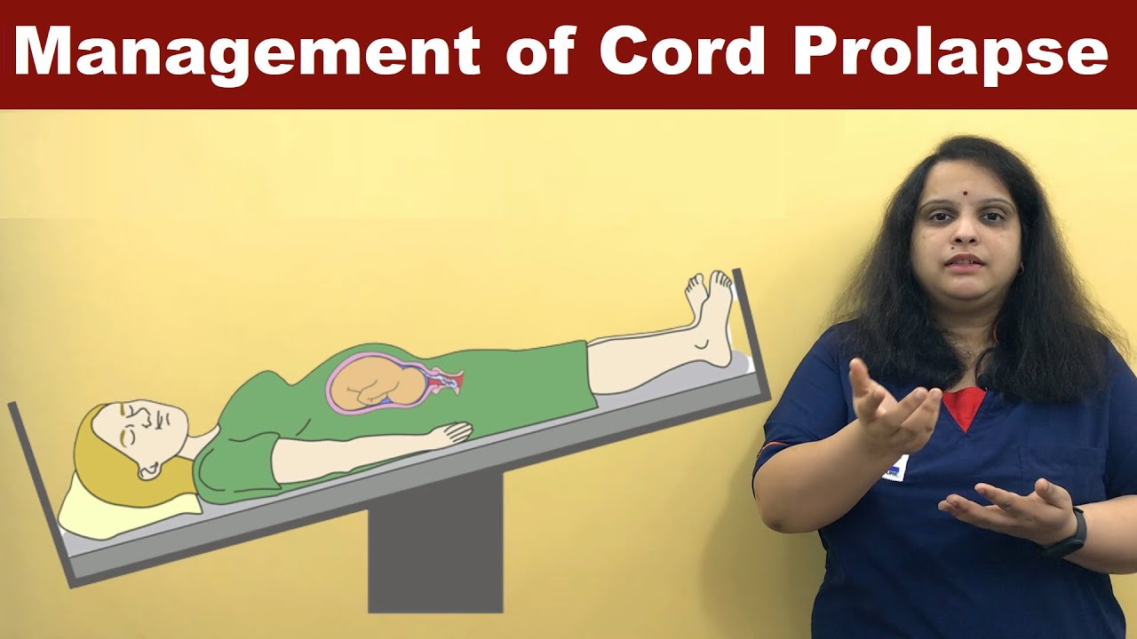 Cord Prolapse Management | Nursing Lecture