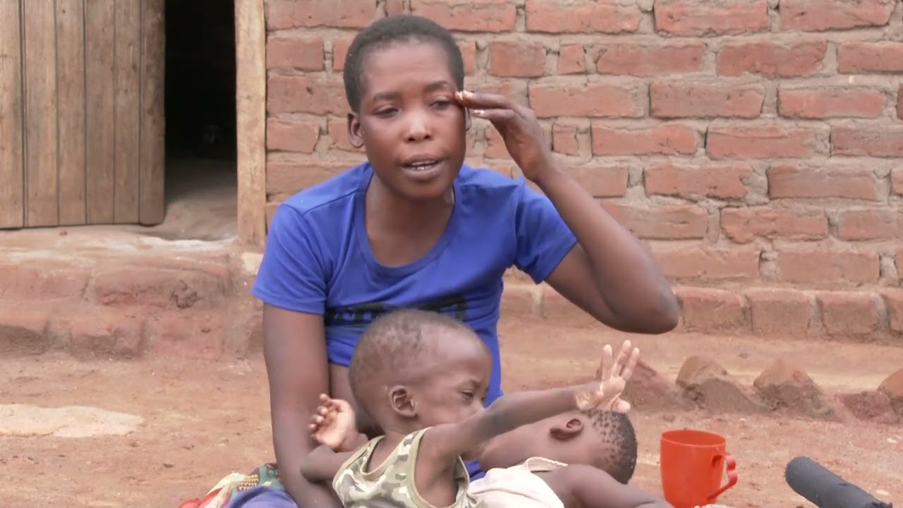 CONJOINED TWINS TO BENEFIT FROM SOCIAL CASH TRANSFER
