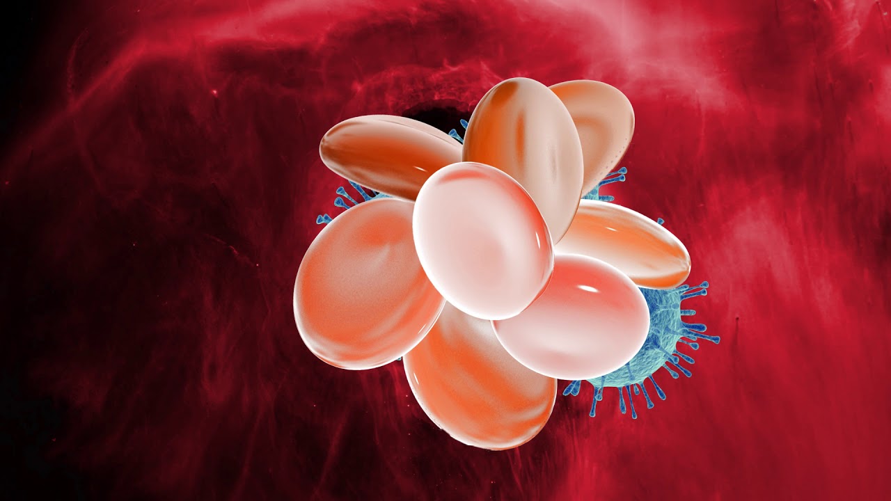 How Opdivo Cancer Treatment Works (Update)