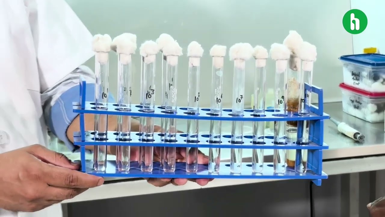 Details about CFU count and Serial Dilution Technique