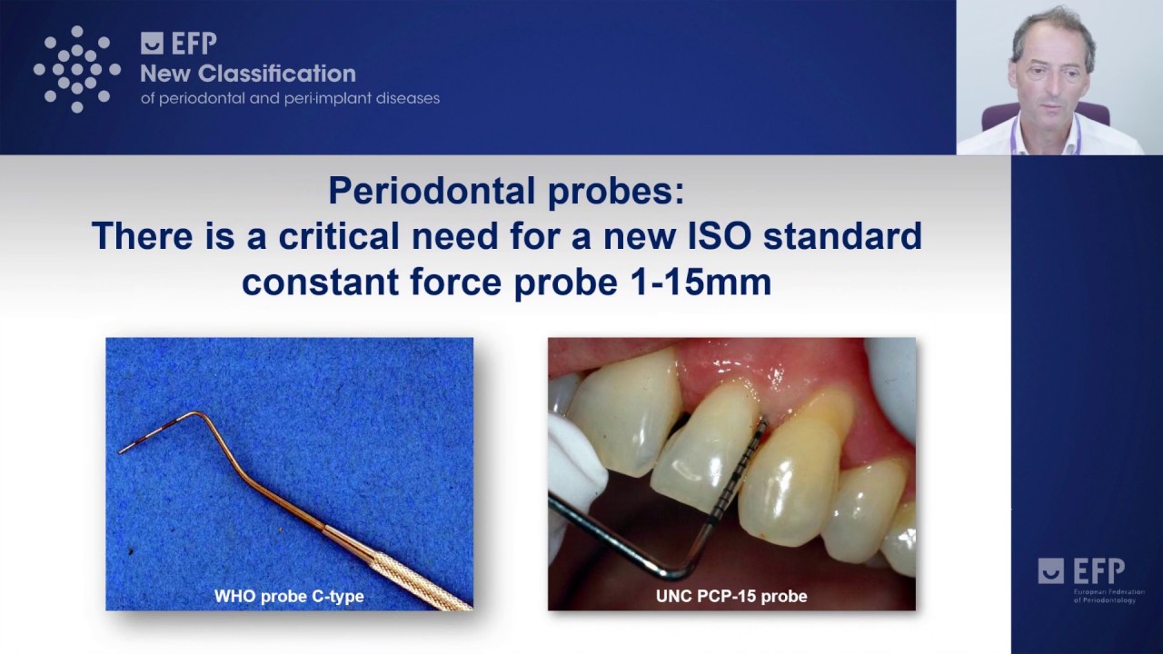 Plaque-induced gingivitis: case definition and diagnostic considerations - tutorial by Iain Chapple