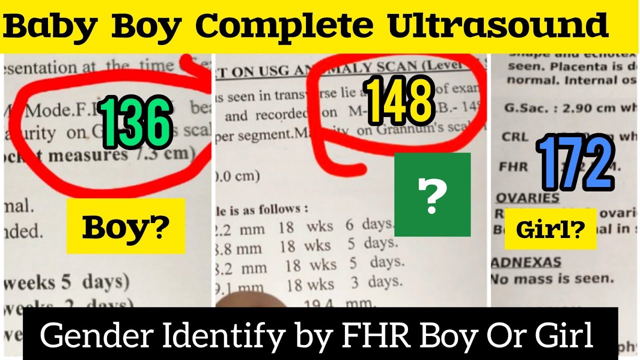 Ultrasound Showing Baby Boy !! All Pregnancy Ultrasound Report's/ Fhr Of Baby Boy #babyboyscan