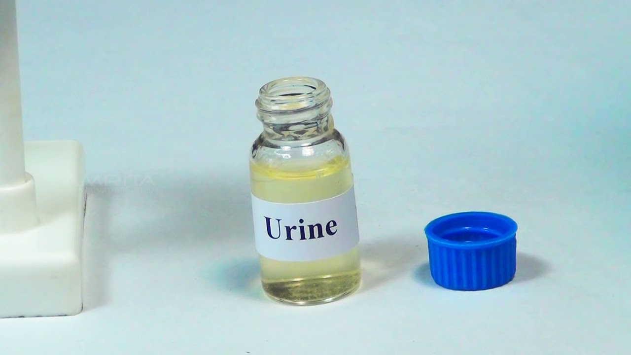 Detection of Bile Salt in Urine - MeitY OLabs