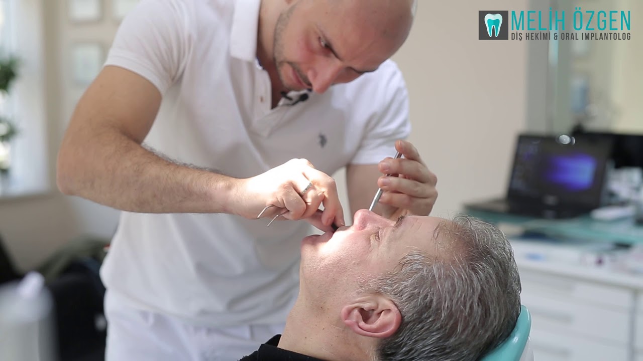 6 Tane İmplant Yaptıran Hasta Yorumları