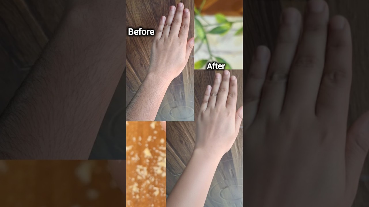 Unwanted hair part-2 #shortsfeed #youtubeshorts #algorithm #explorepage #fyp #removehair #diy #skin