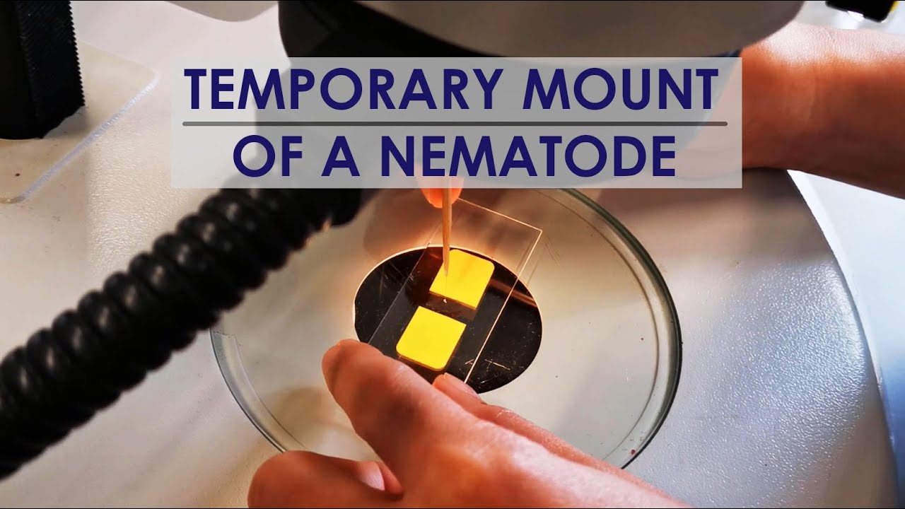 TEMPORARY MOUNT OF NEMATODE