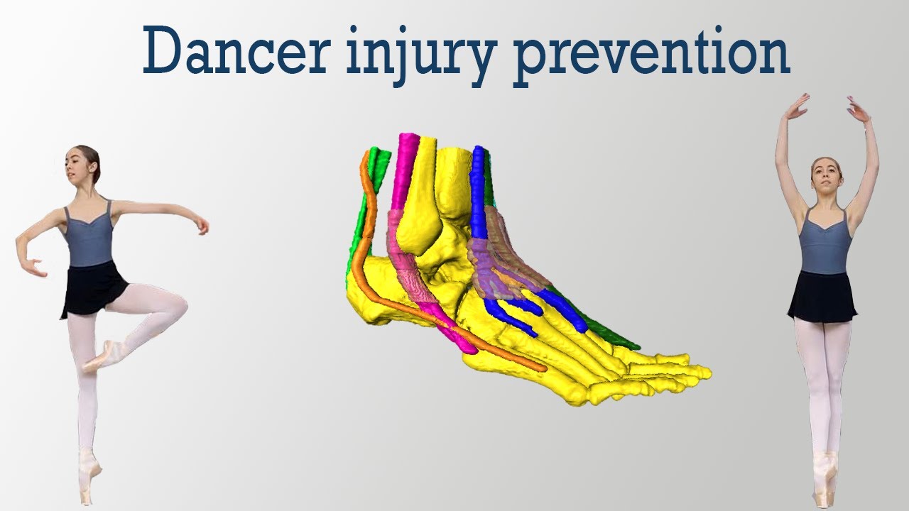 Flexor Hallucis Longus Tendinopathy & Posterior Ankle Impingement in Ballet Dancers