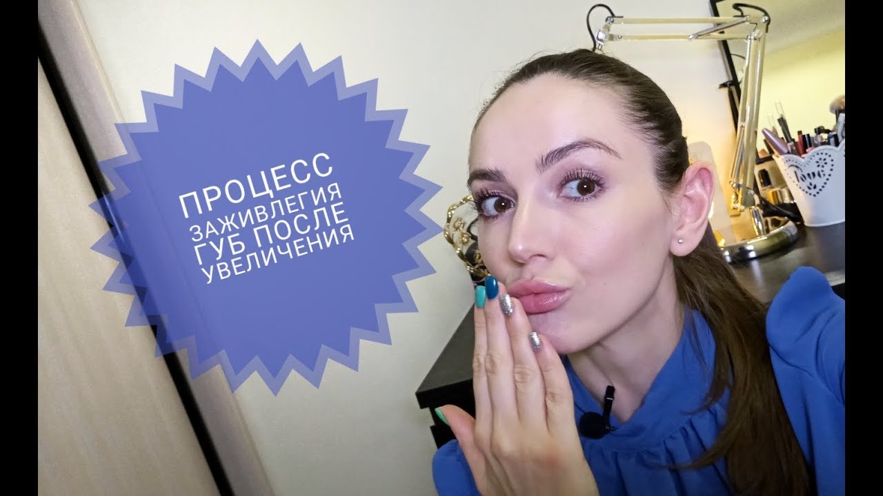 Мой первый опыт увеличения губ, процесс заживления. Dr.Zonova beautyclinic
