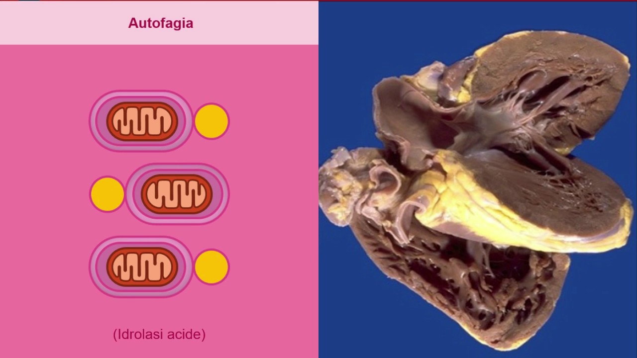 Atrofia, metaplasia e displasia