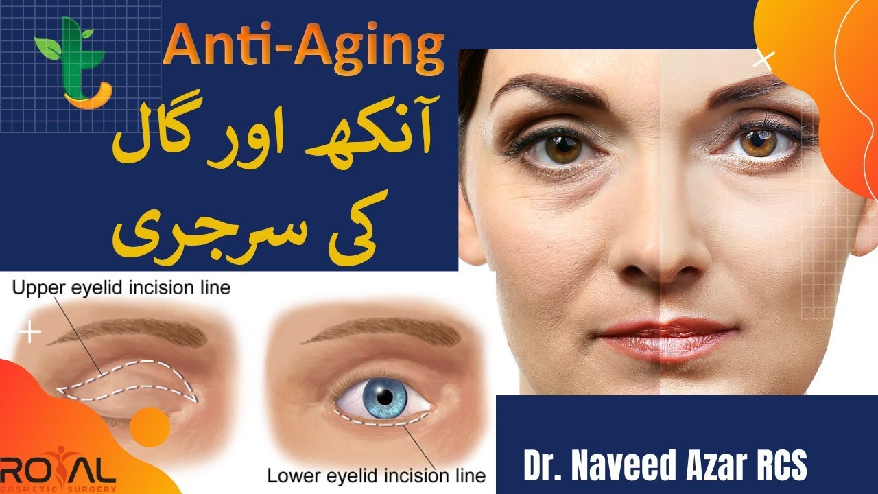 Eyelid Surgery , Mid Face Lift & Anti Aging Explained By Dr. Naveed Azhar in Urdu - Tabib.pk