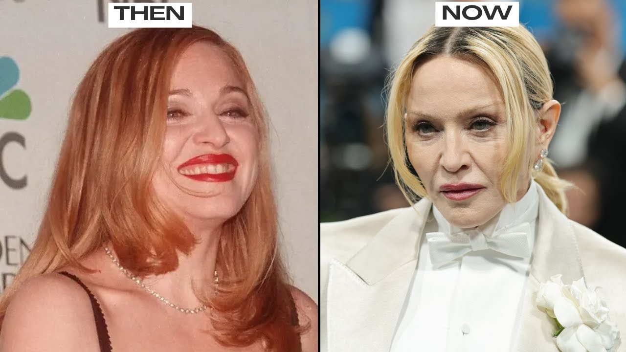 Plastic Surgeon Reveals Madonna’s Cosmetic Surgery Secrets!