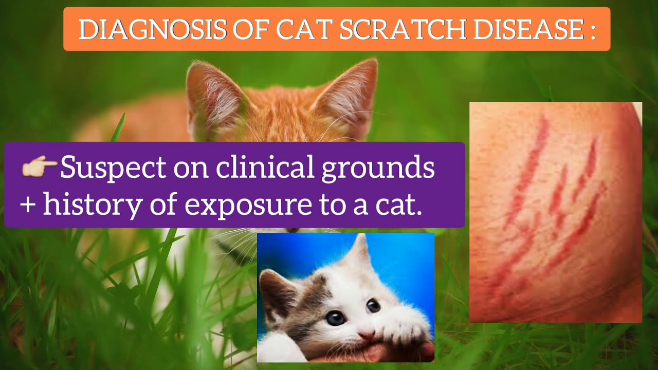 Cat Scratch Disease, Symptoms, Diagnosis, Treatment & Perinaud Oculoglandular Syndrome