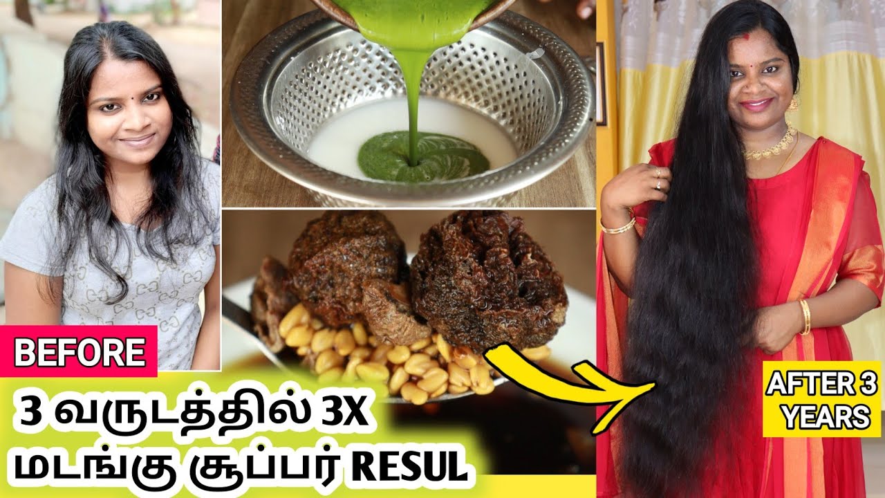 ♥️ MY SECRET REMEDY♥️ 1 Month Result of HairGrowth & Thickness - 3 வருடத்தில் 3XX Hair growth