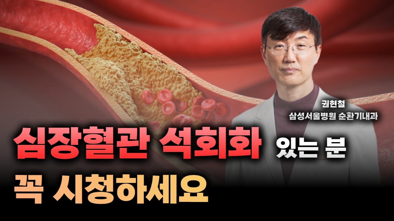 굳어가는 심장 혈관, 관상동맥 석회화! 어떻게 하면 될까? / 삼성서울병원 순환기내과 권현철