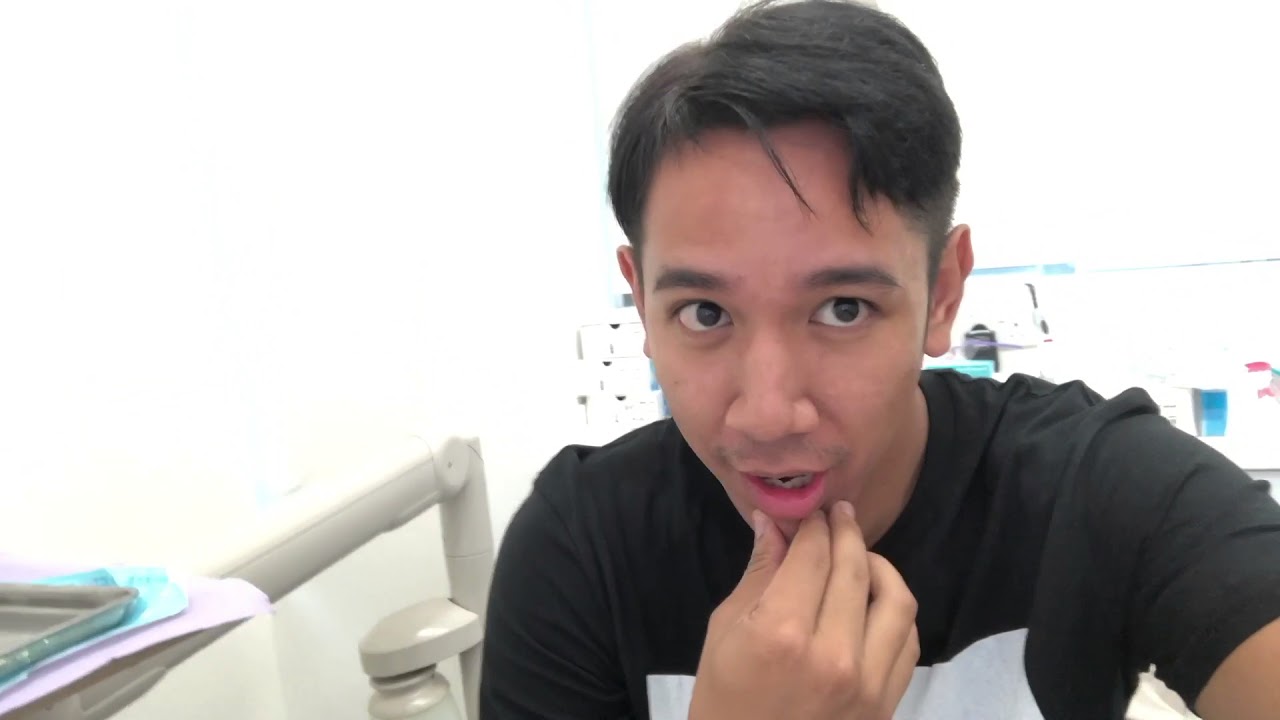 Finally i’m on INVISALIGN!