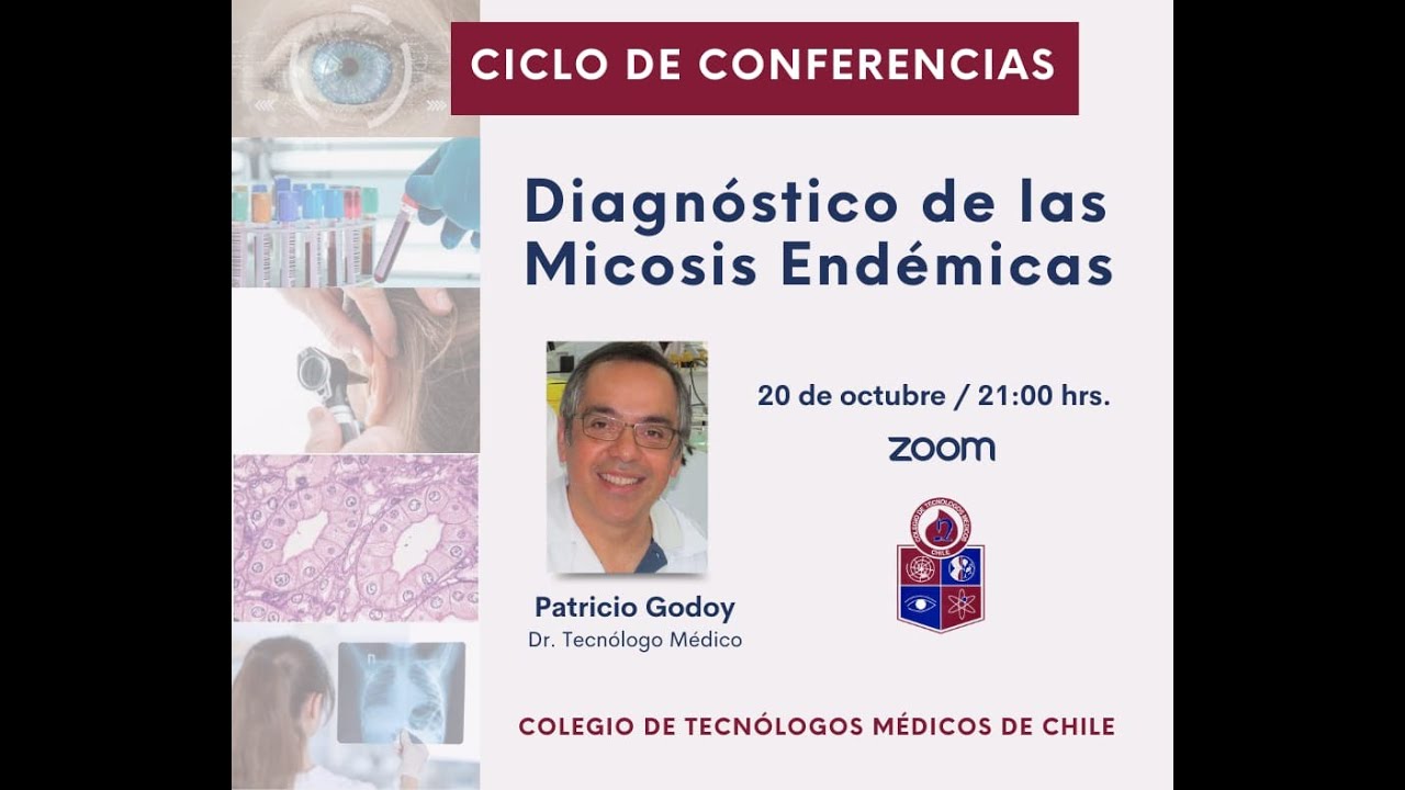 Diagnóstico de la Micosis Endémica