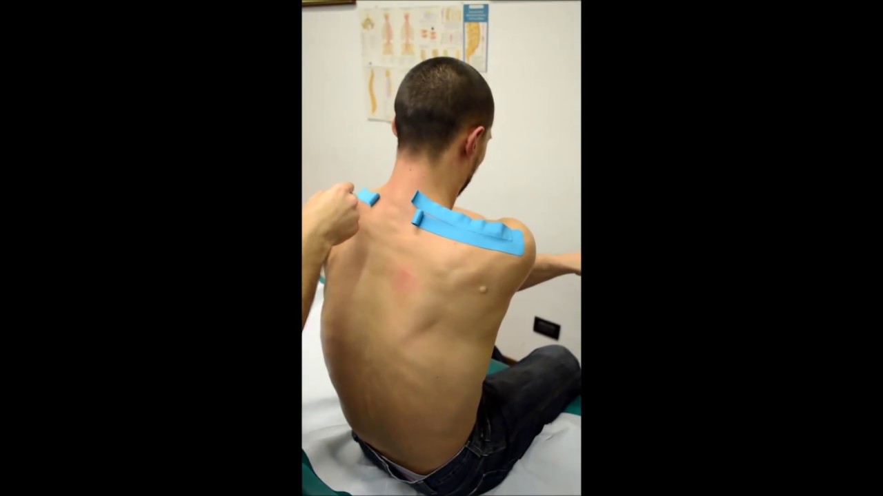Kinesio taping collo e spalle sul muscolo trapezio