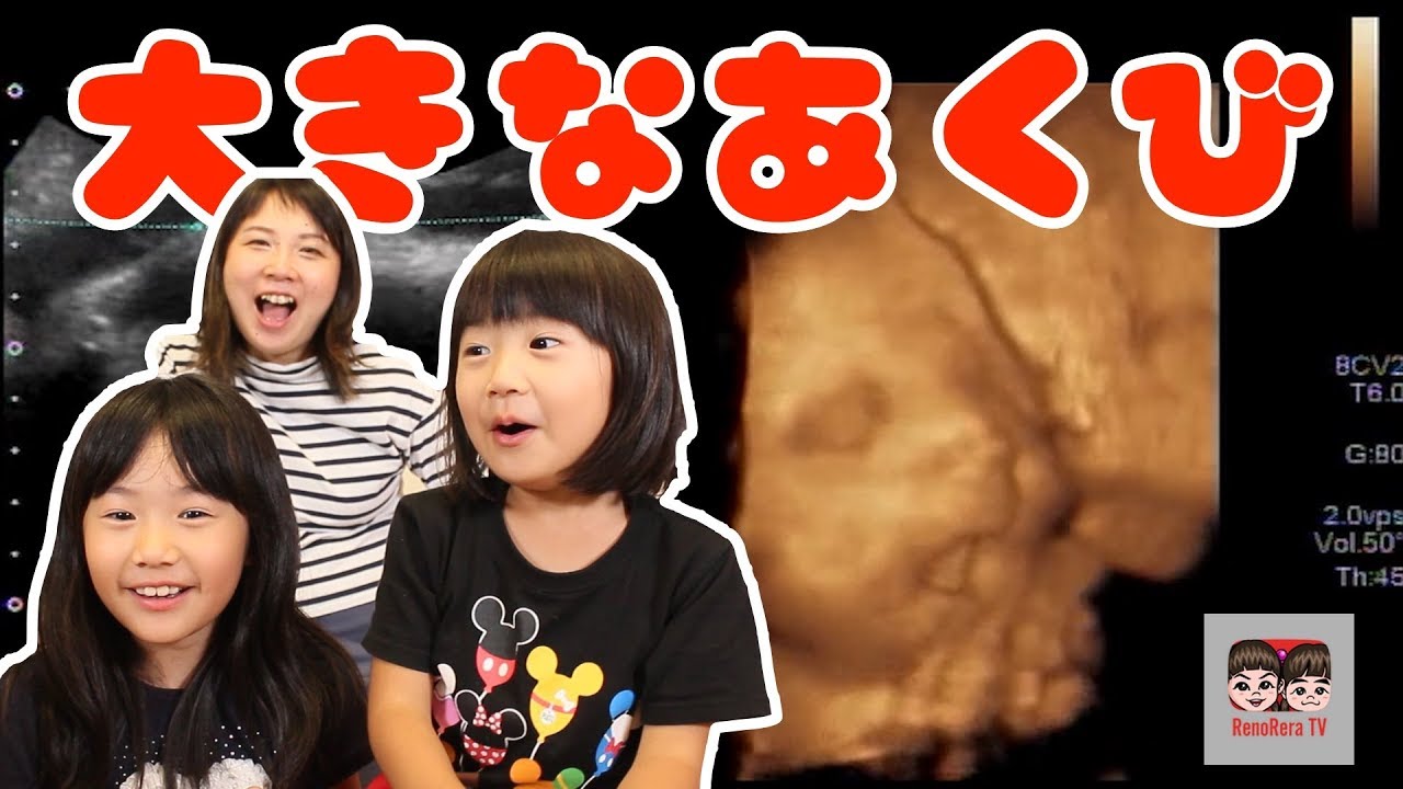 【出産記録】お腹の中で大きなあくびをする赤ちゃん！めっちゃかわいい❤︎れのれらTV【