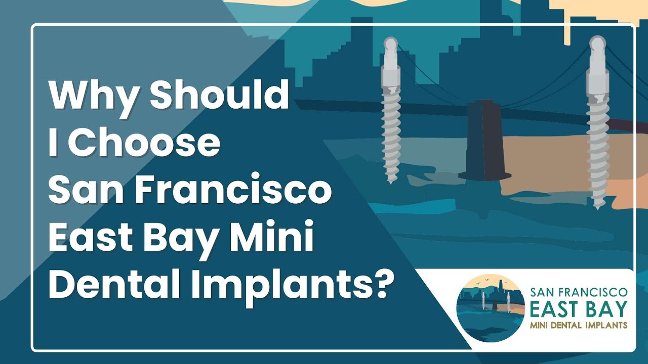 Why Choose SF East Bay Mini Dental Implants? | Dr. Rose Magno #MiniDentalImplants #DentalImplants