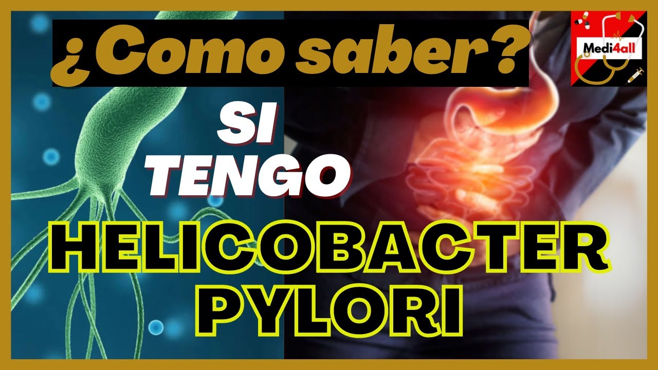 Como saber si tengo Helicobacter pylori? (Gastritis o Ulcera Estomago?) | Sintomas y Tratamiento