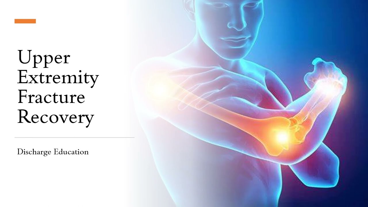 Upper Extremity Fracture edu 1